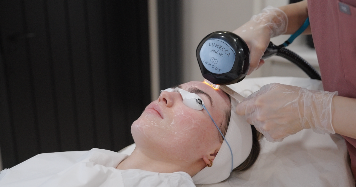 Someone receiving Lumecca Peak treatment.