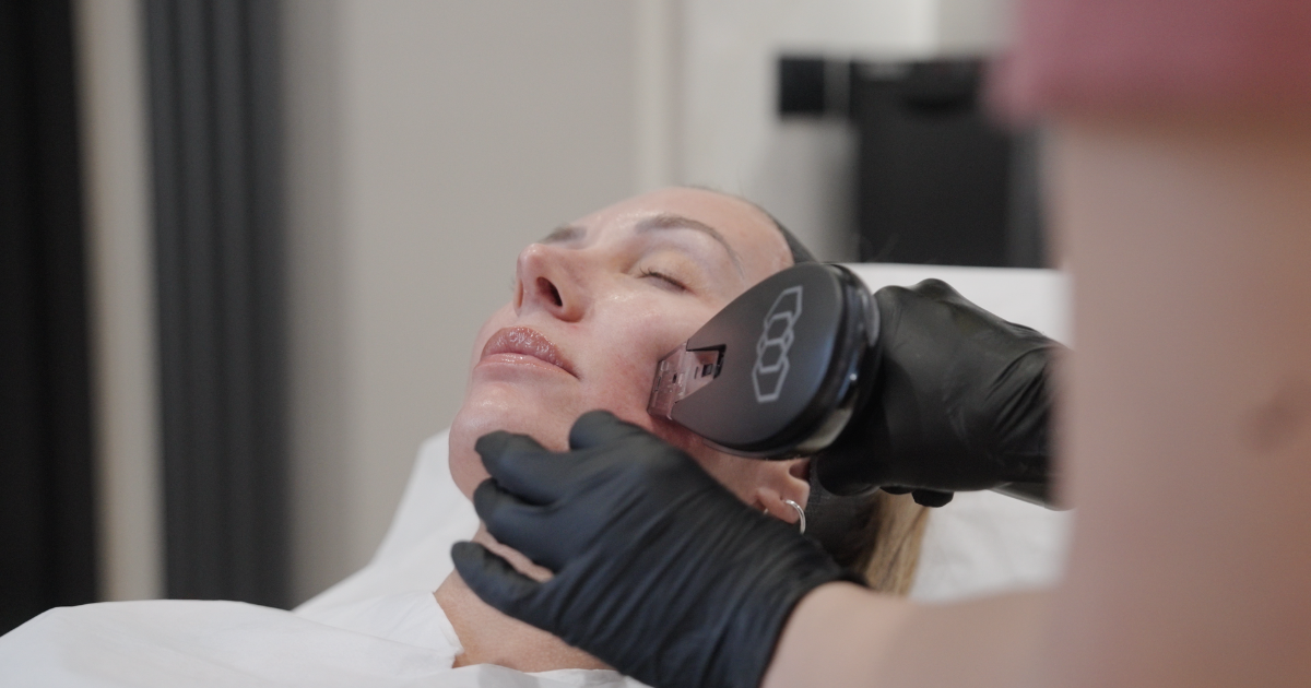 Someone receiving Morpheus8 treatment.