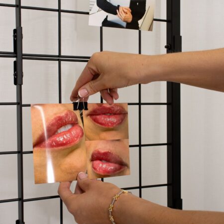 Caroline from BU Aesthetics holding up comparison photos of a successful lip filler treatment