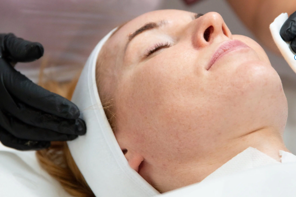 An image of a woman receiving mesotherapy