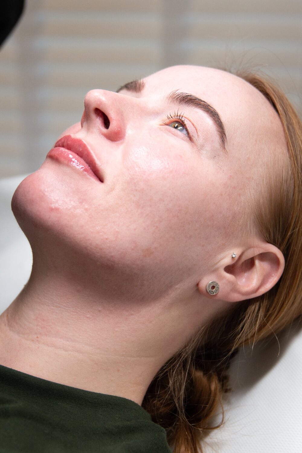 A patient from BU Aesthetics undergoing a treatment for the DESO Face and DESO Body treatment