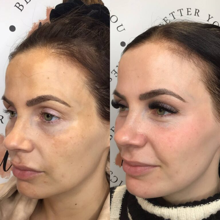 A stunning before and after image of a woman undergoing the Obagi Medical Grade Skincare treatment with BU Aesthetics