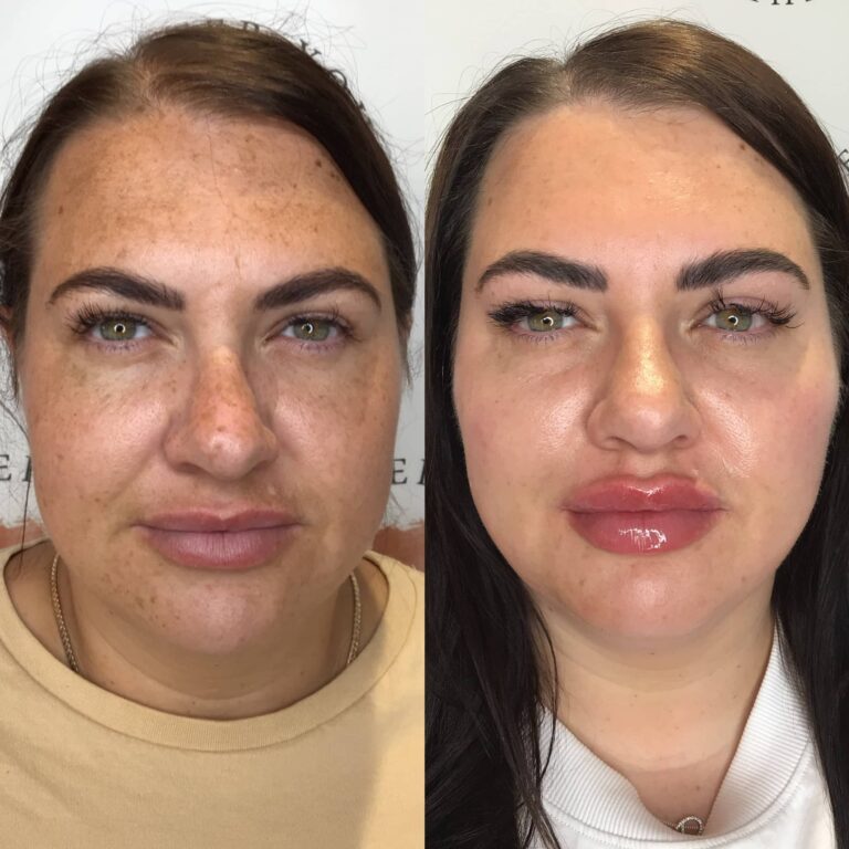 A trasformational before and after picture showing the possibilities of undergoing the Obagi Medical Grade Skincare treatment