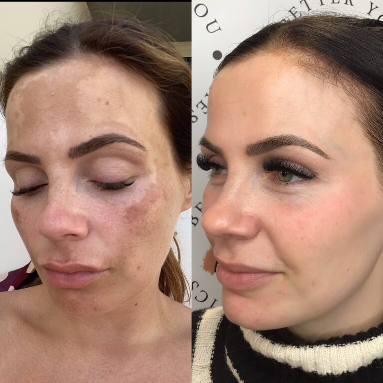 A side by side comparison of a woman lacking confidence before taking the Obagi Medical Grade Skincare treatment - to after the Obagi Medical Grade Skincare treatment having a fresh wave of confidence being instilled