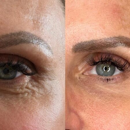 Polynucleotides Results